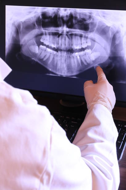 Best Emergency Dental Filling Replacement  in Grant, MI